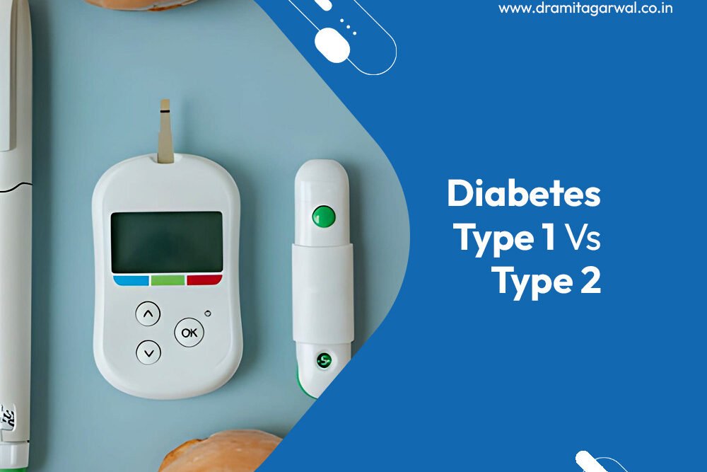 Diabetes type 1 vs type 2