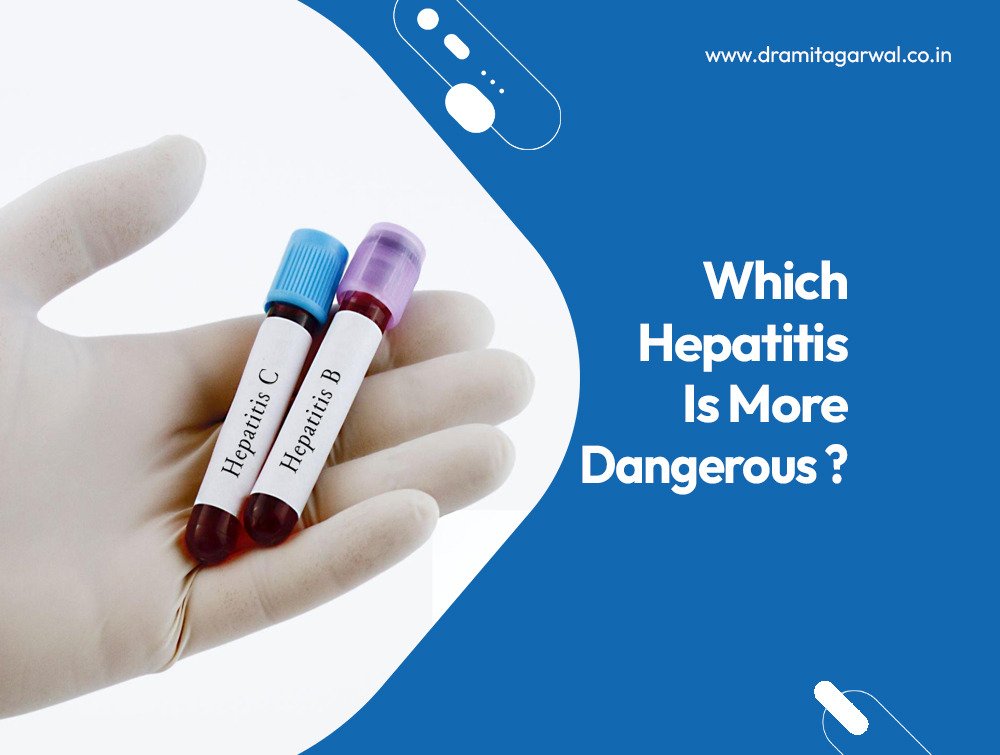 Which Hepatitis Is More Dangerous?