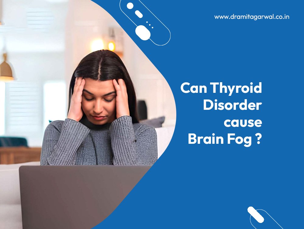 Can Thyroid Disorder Cause Brain Fog?