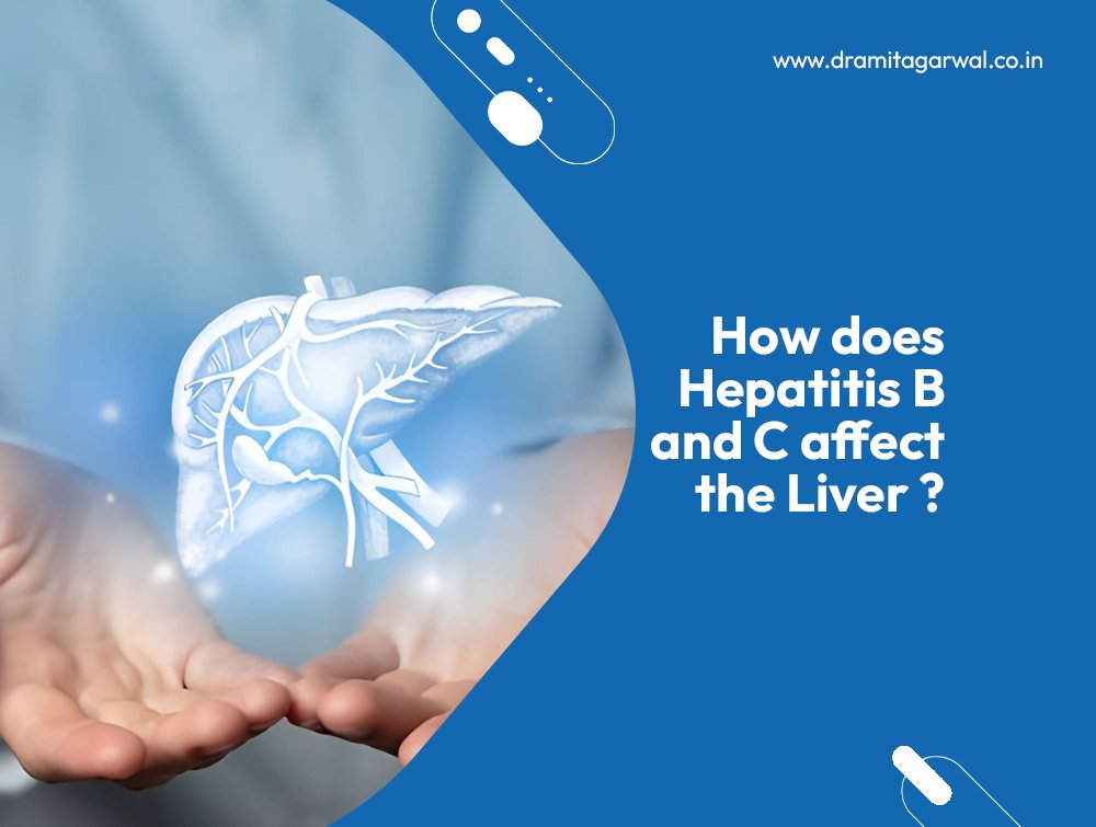 How Does Hepatitis B And C Affect The Liver?
