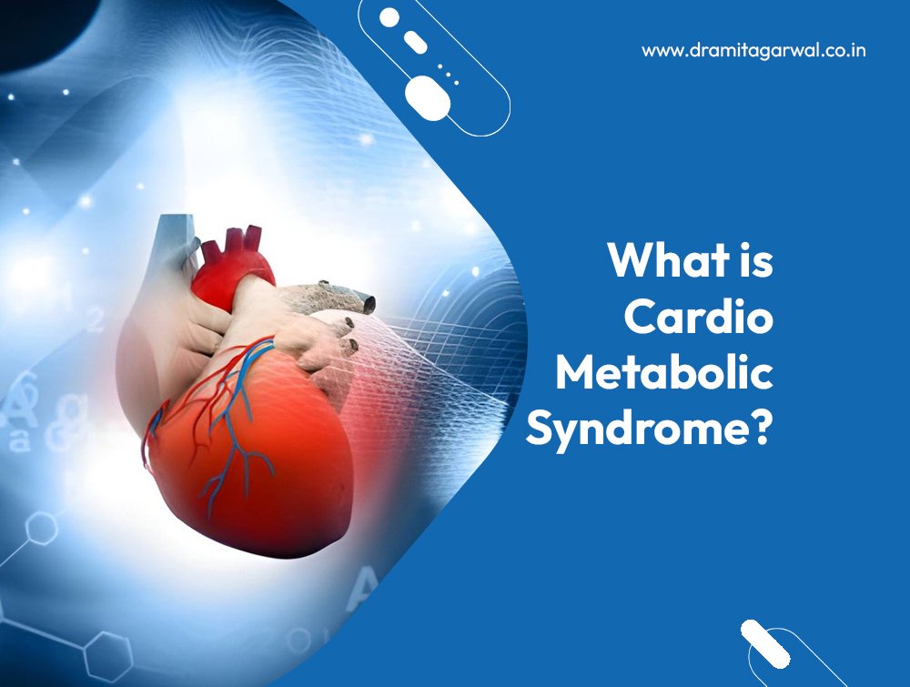 What is Cardio Metabolic Syndrome?